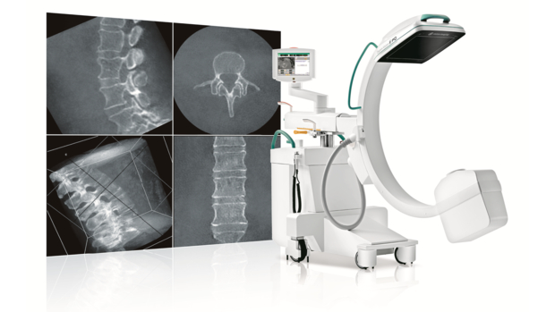 Christie Innomed Launches Ziehm Vision RFD 3D for Unparallel Surgical Imaging